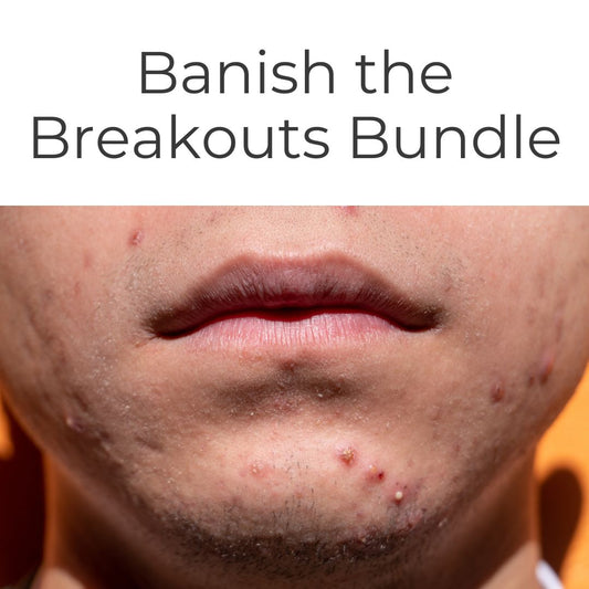 Banish the Breakouts Bundle